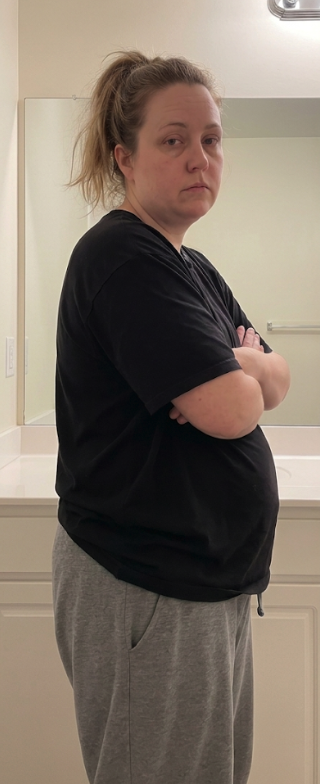 Hannah at month 0, before starting the program