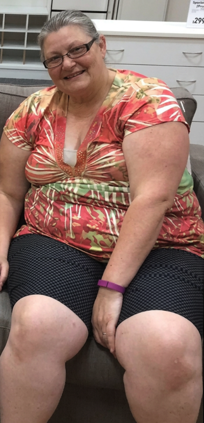 Sarah at month 0, before starting the program, at 268 lbs