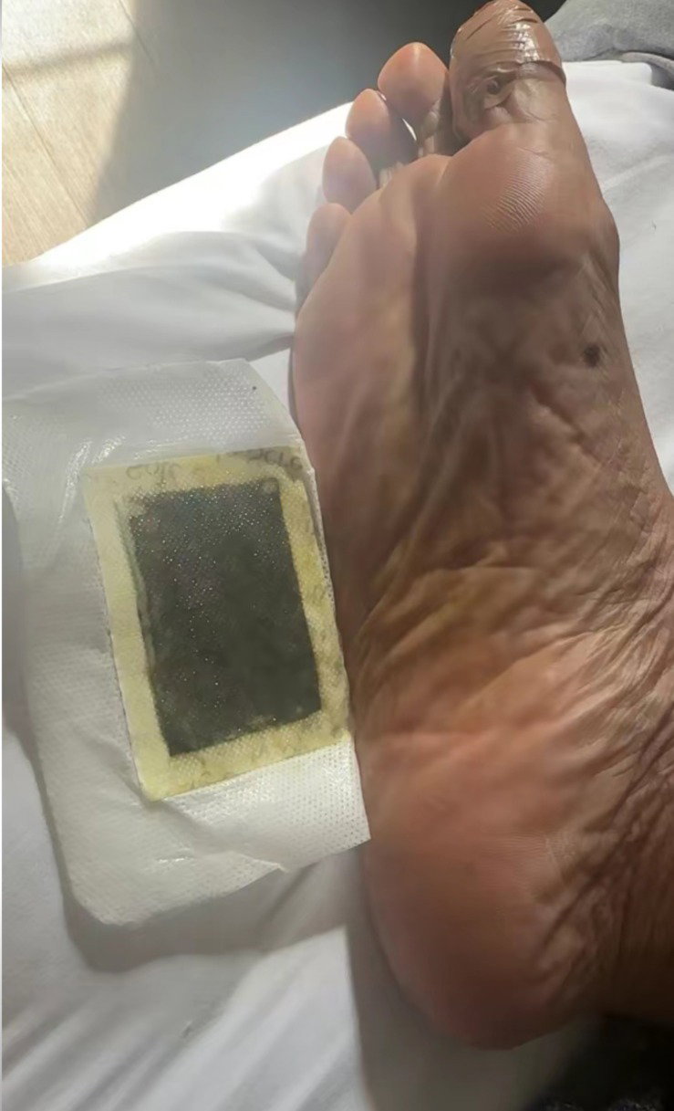 Foto de Leonardo con sus parches SOONÉ usados por la mañana