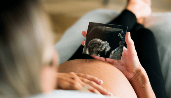 Eine schwangere Frau hält ein Ultraschallbild über ihren Bauch und liegt auf einer grauen Fläche.