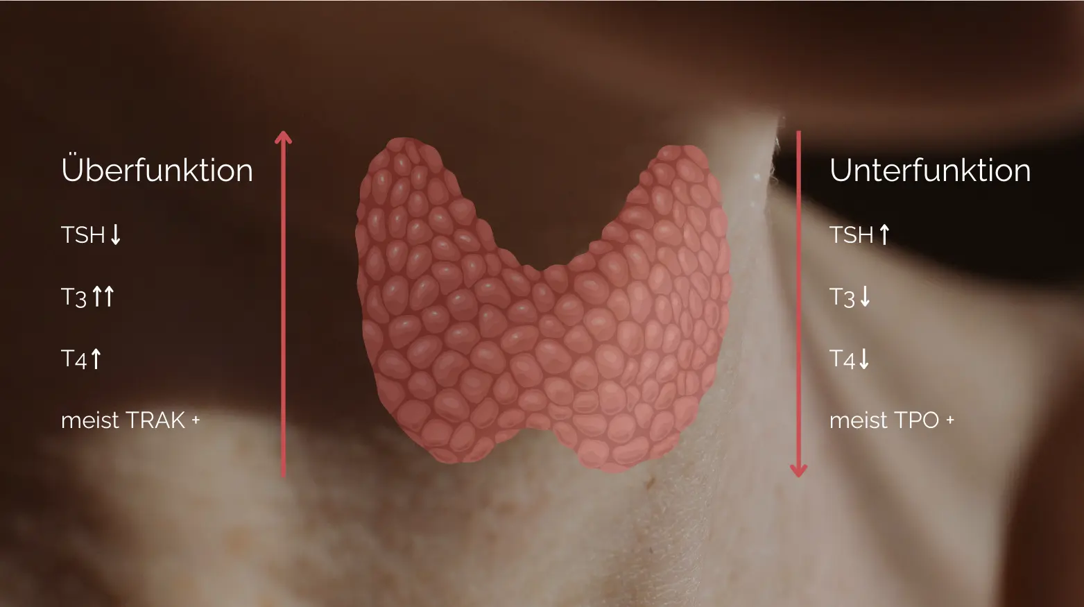 Darstellung der Schilddrüse mit den wichtigsten Parametern für Über- und Unterfunktion (TSH, T3, T4).