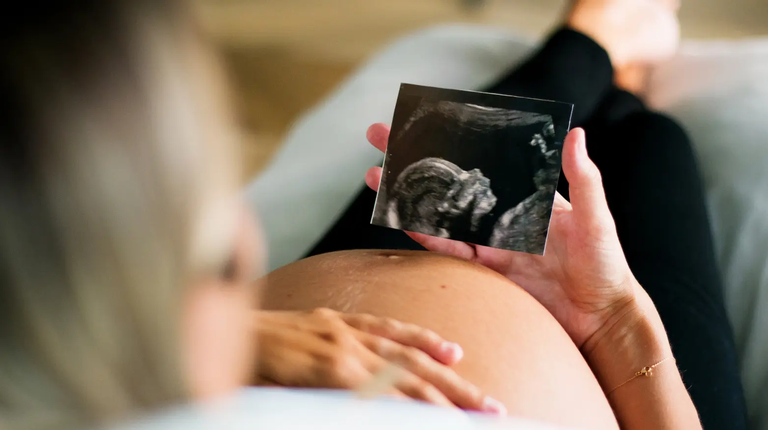 Eine schwangere Frau hält ein Sonogrammbild über ihren Bauch und betrachtet es genau.