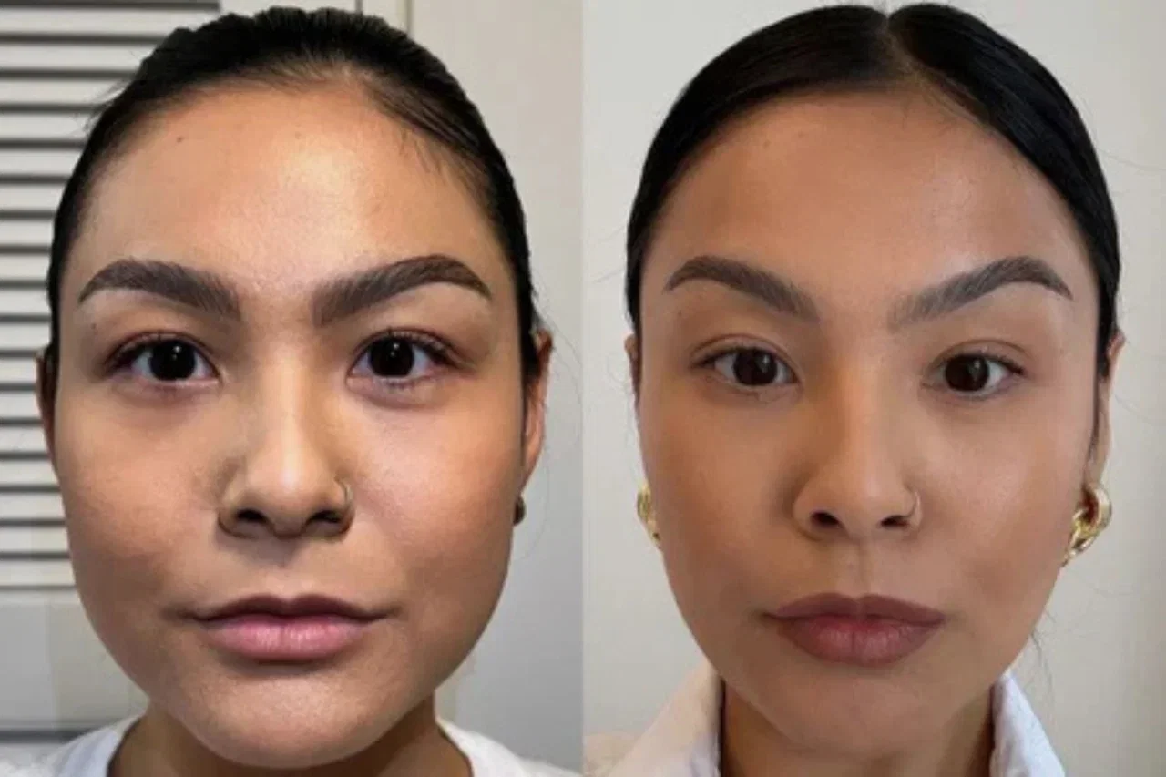 Mona, 33 — före och efter