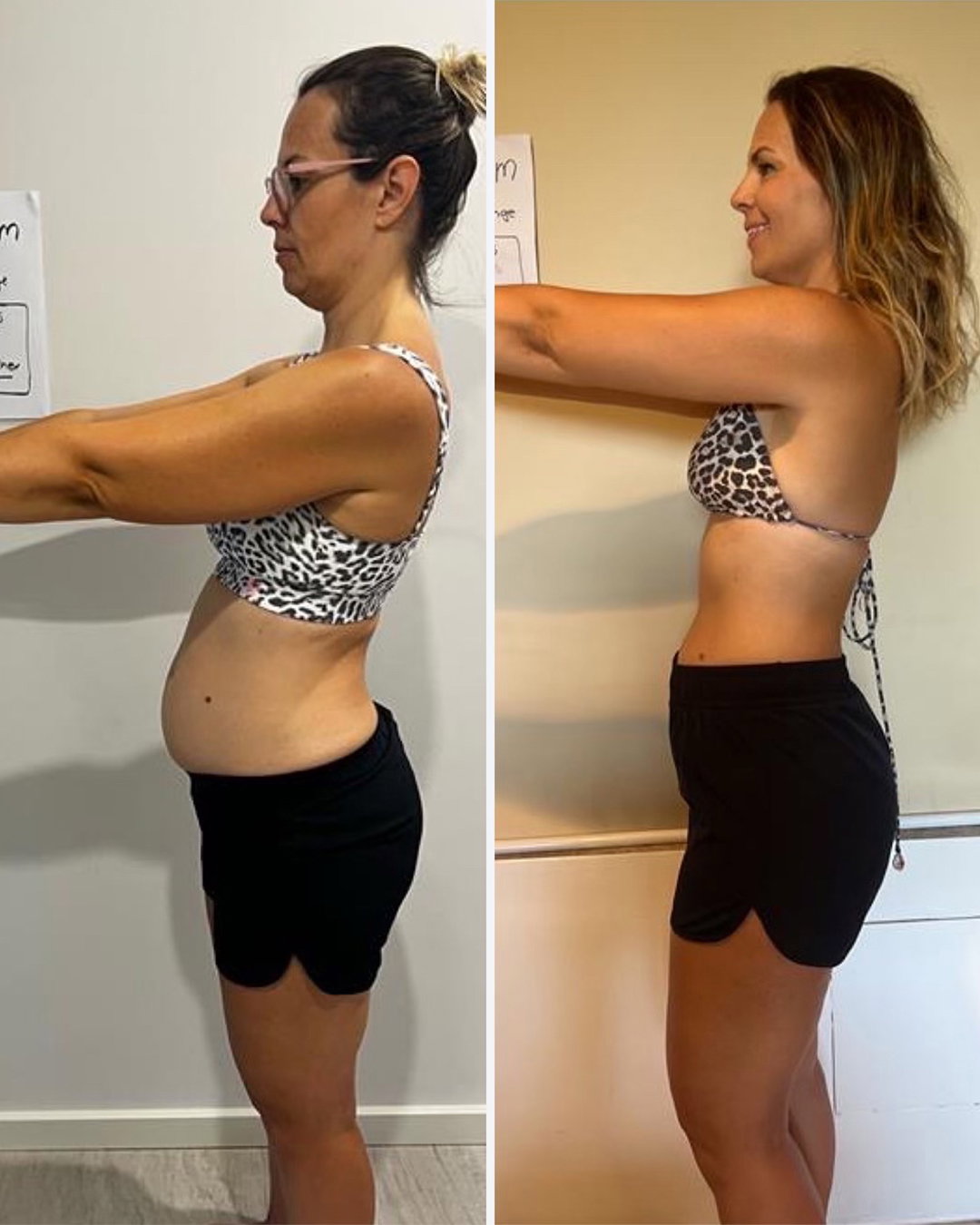 Client's before and after transformation