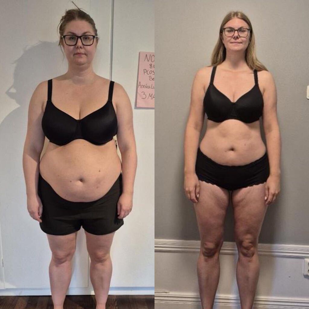 Client's before and after transformation
