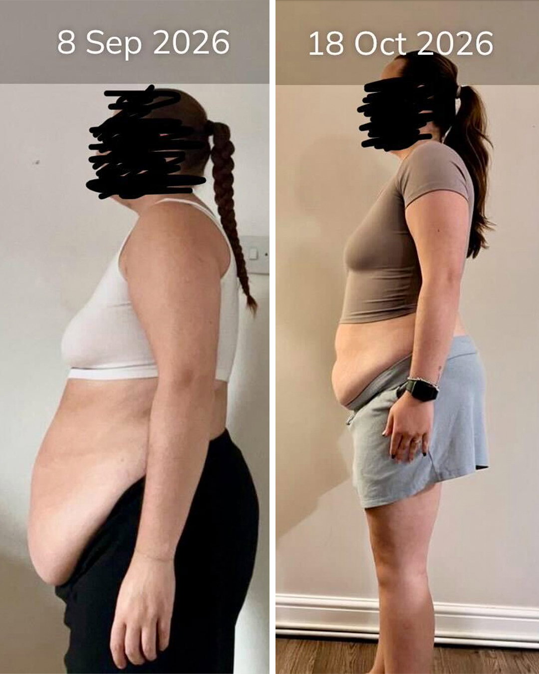 Zoe's before and after transformation