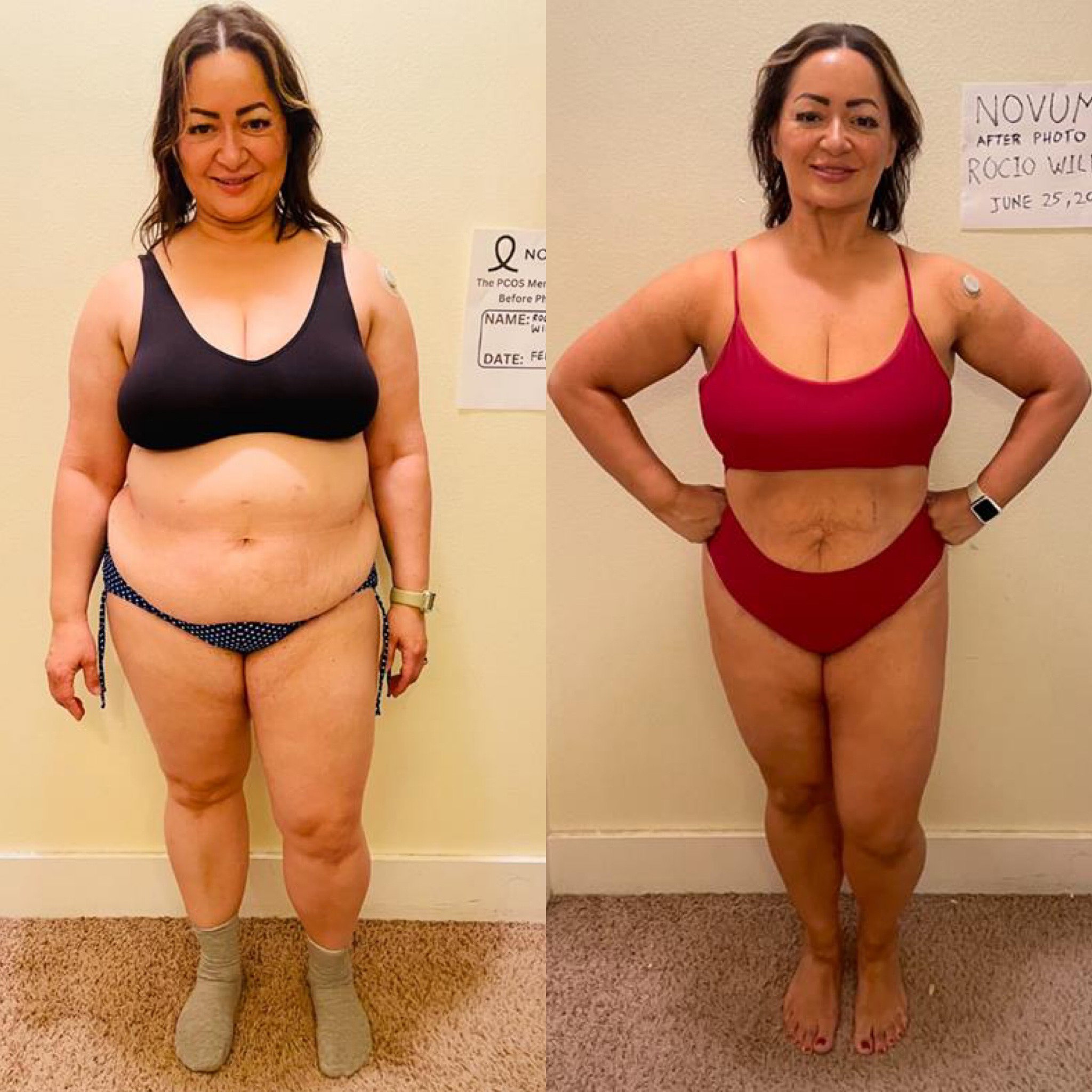 Rocio's before and after transformation