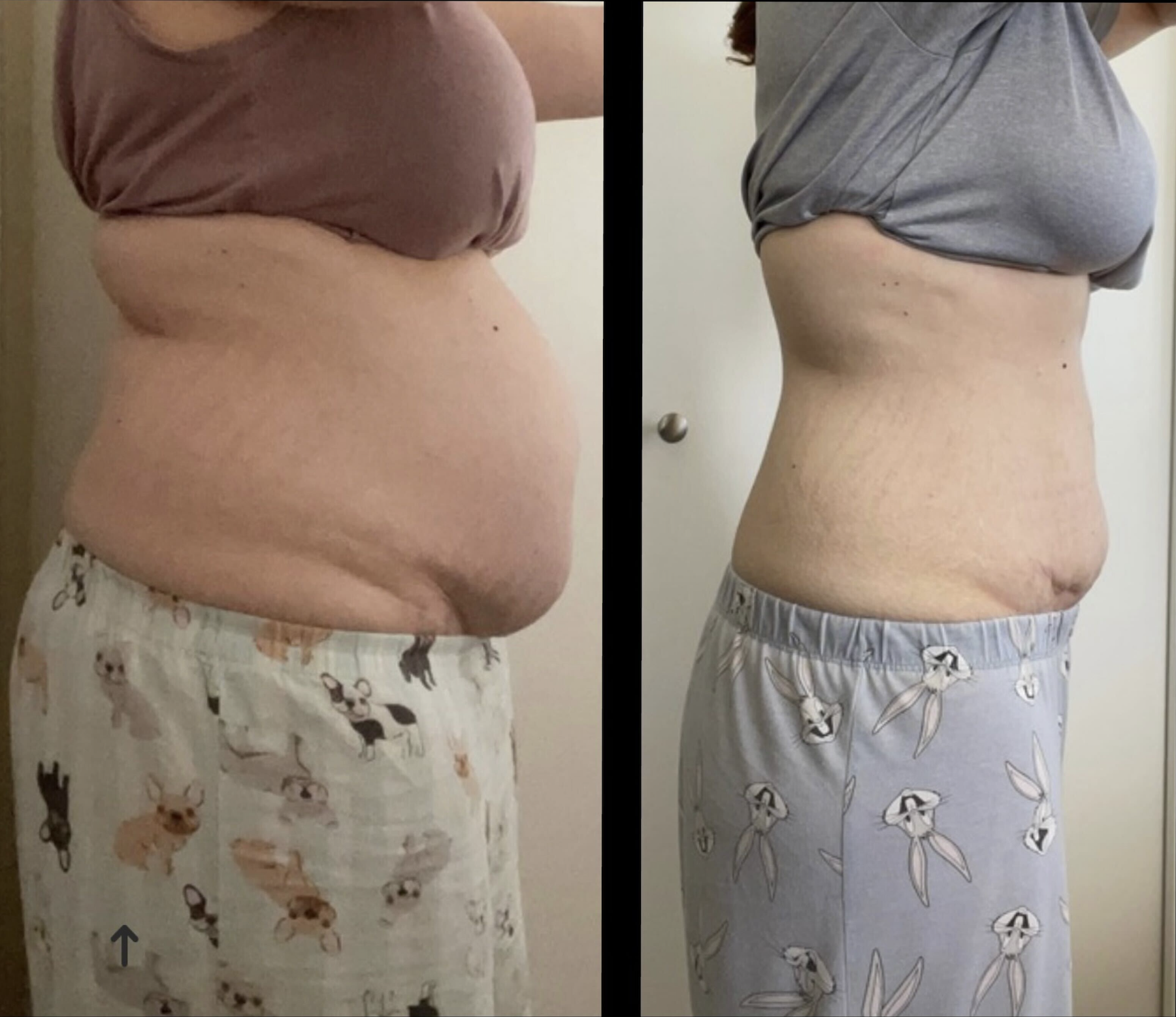 Trista's before and after transformation