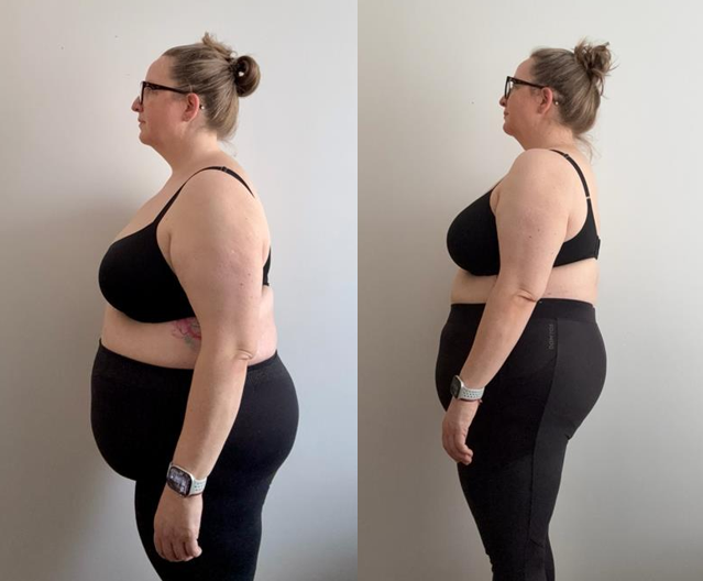 Client's before and after transformation