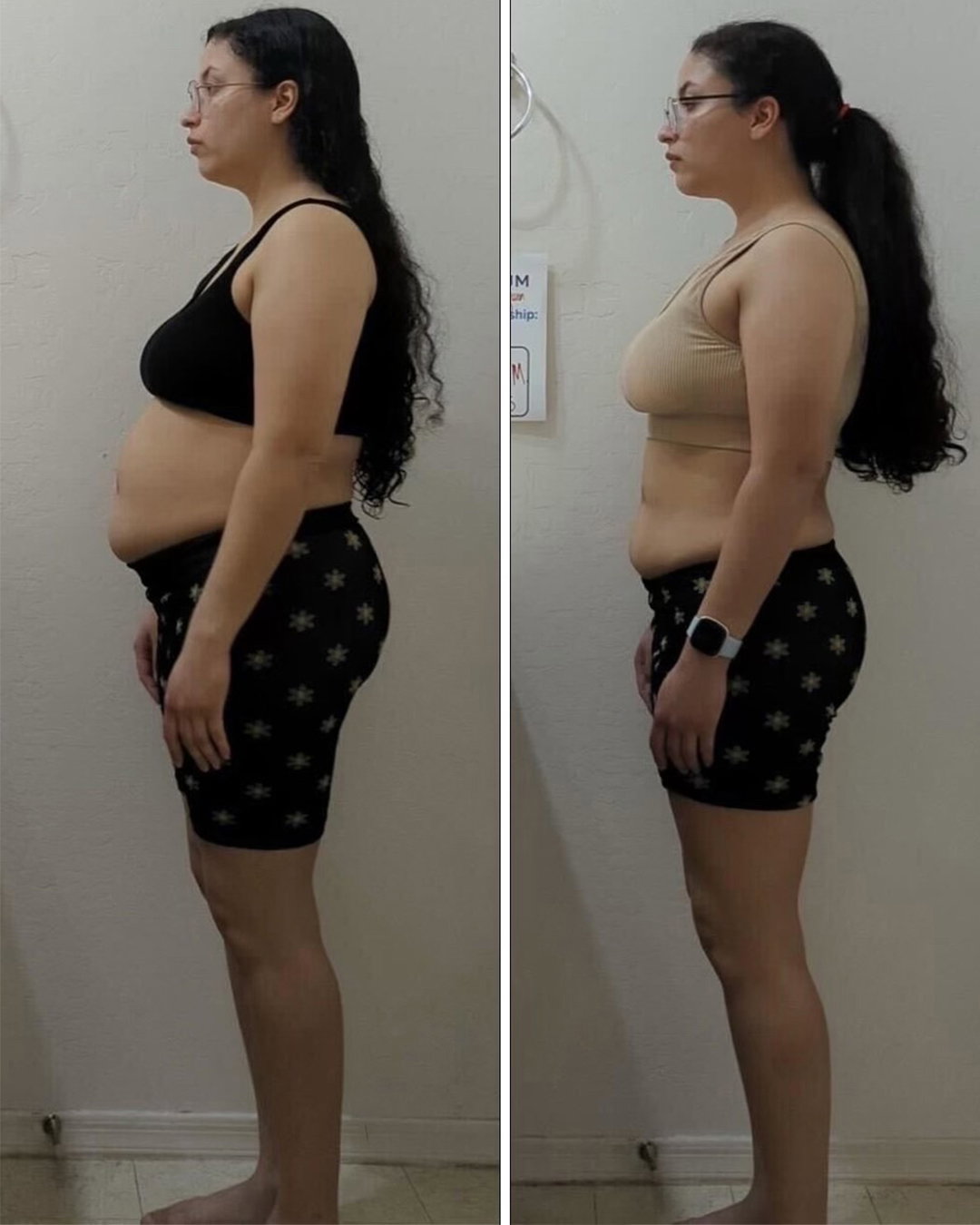 Client's before and after transformation