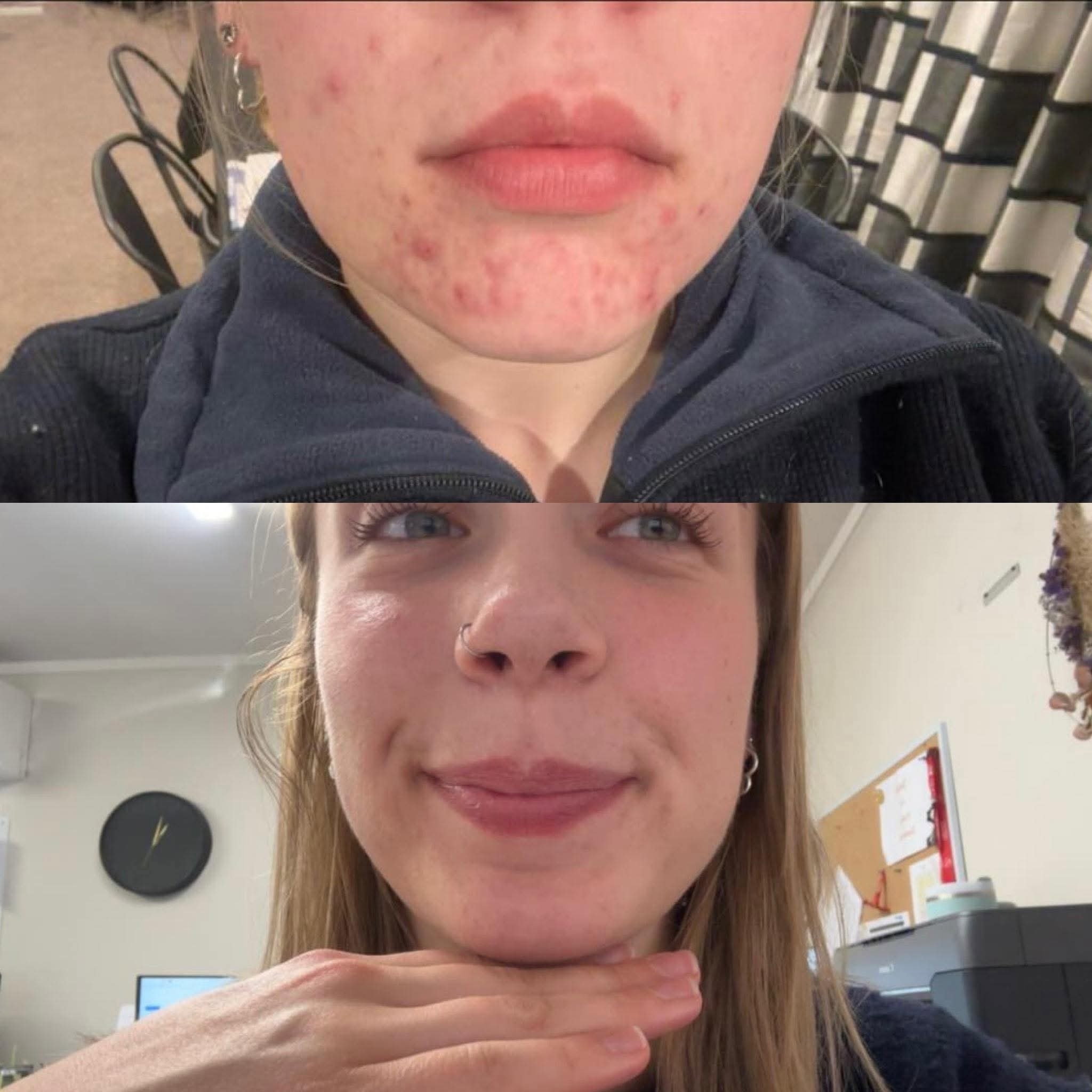 Mikayla's before and after transformation