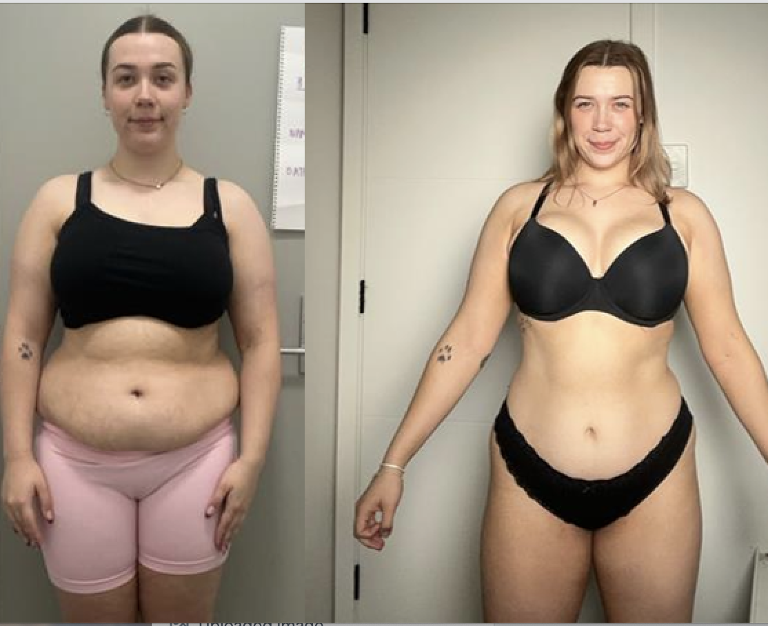 Mikayla's before and after transformation