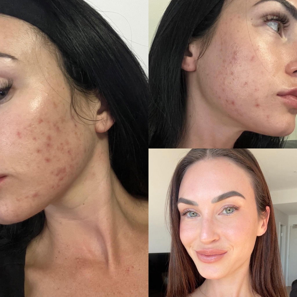 Sarah's before and after transformation