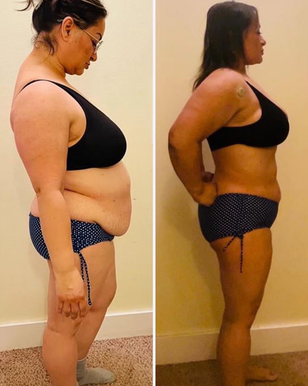 Rocio's before and after transformation
