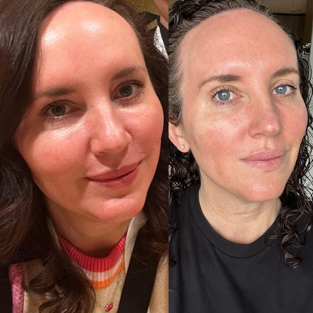 Nichole's before and after transformation