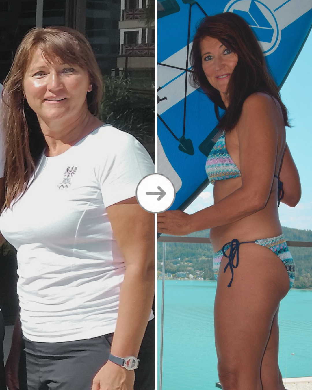 Margit Melmer vorher und nachher