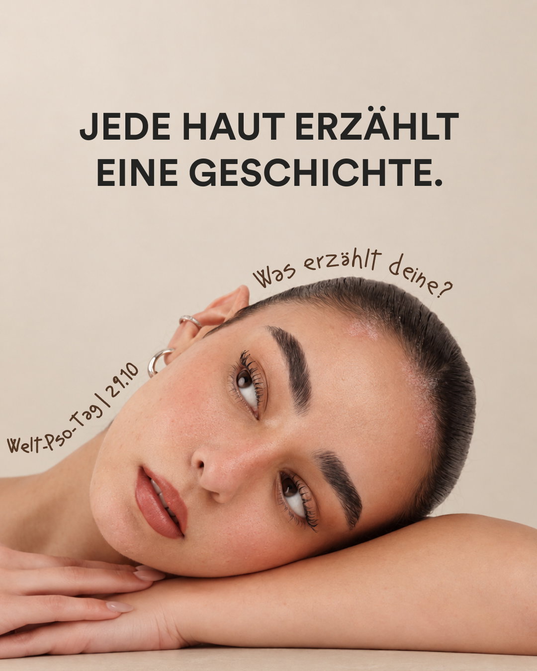 Frau legt den Kopf auf ihre Arme, darüber der Schriftzug „Jede Haut erzählt eine Geschichte. Was erzählt deine?“ und „Welt-Pso-Tag | 29.10“