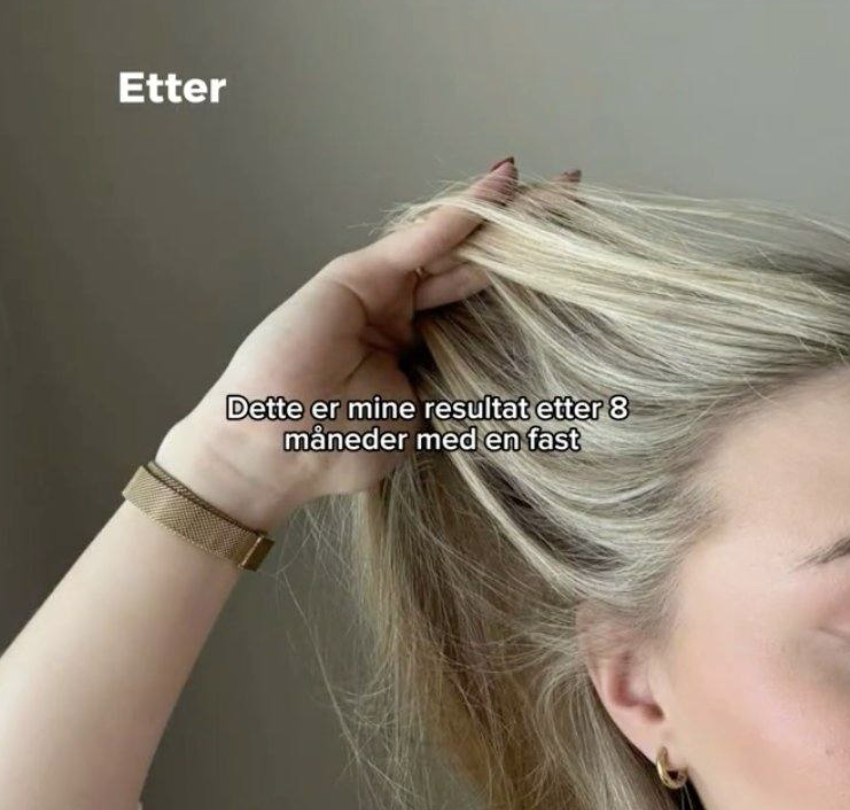 Etter: fyldigere hår ved tinningen etter jevn bruk over tid