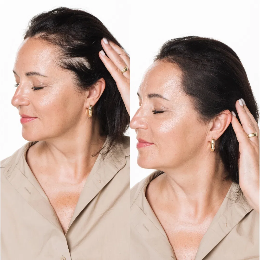 Best Hair Powder for Thinning Hair: Thin, Strong, and Natural Results