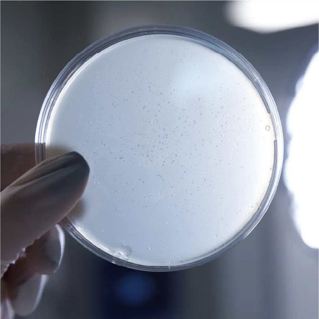 a petri dish with bacteria in it being held up to the light showing how the bacterium eats away the bad bacteria