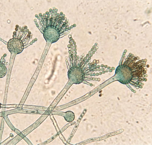 Microscopic view of mold growth