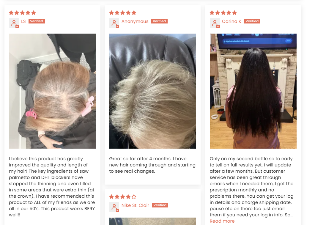 Customer photo from above of a light-brown hair parting held with a pink clip
