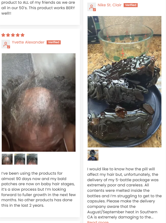 Customer photo from above of a scalp with thinning, bald patches