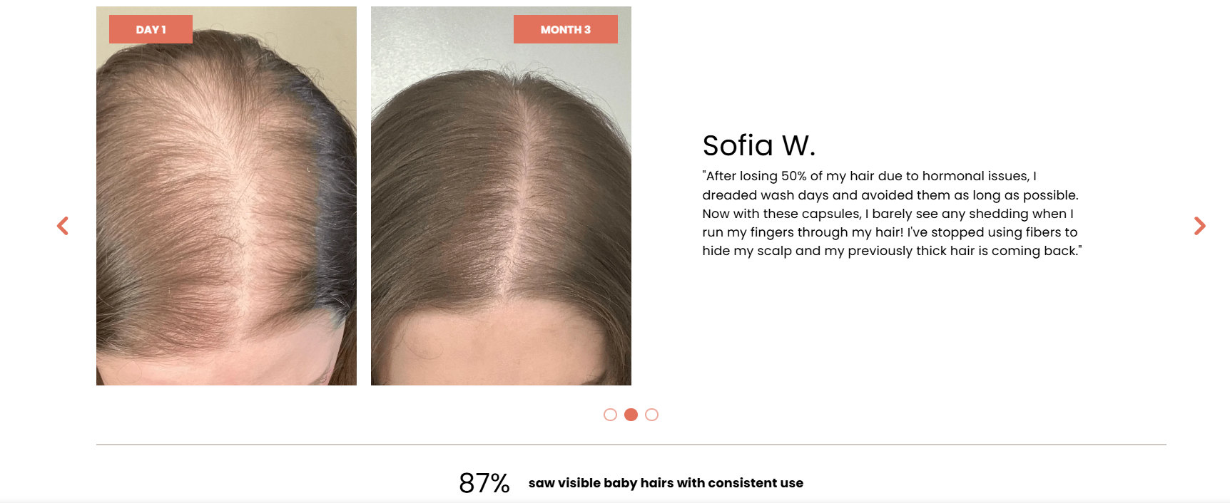 Day 1: Sofia's parting, wide and thin with scalp showing