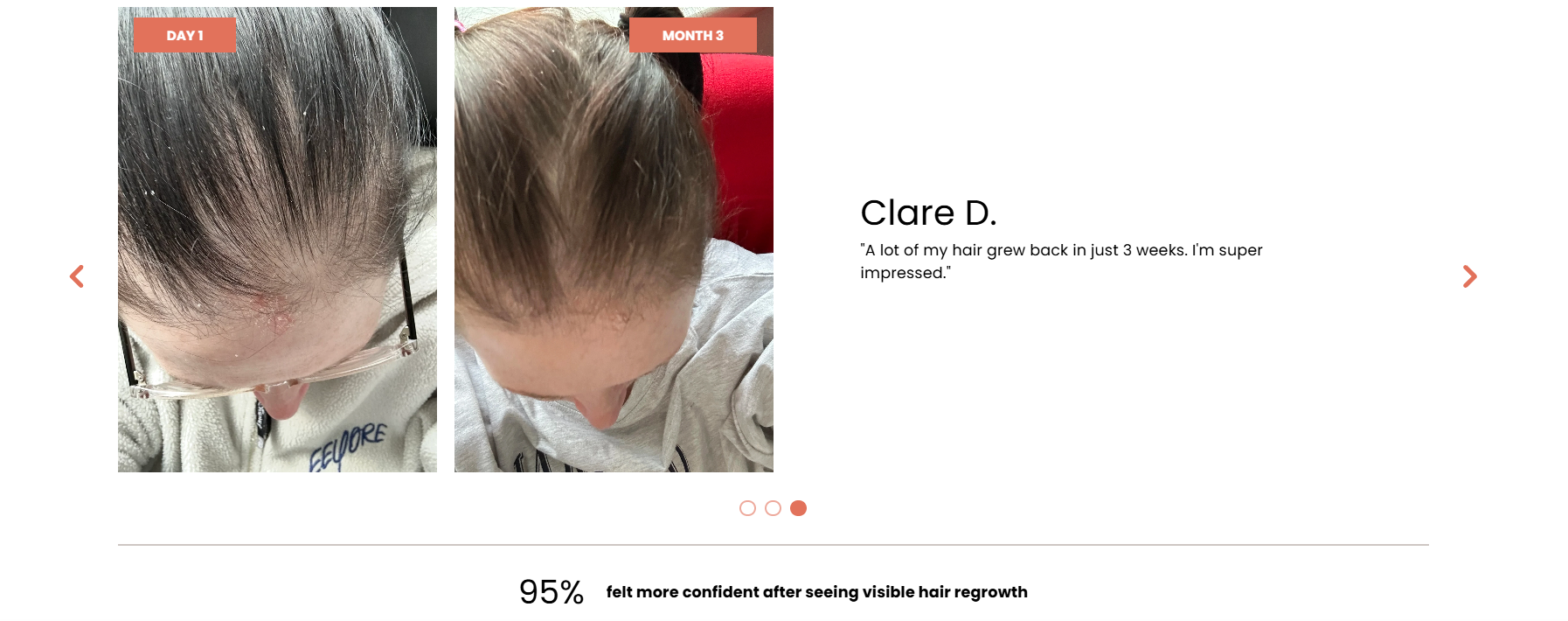Day 1: Clare's parting from above, with thin hair and scalp showing