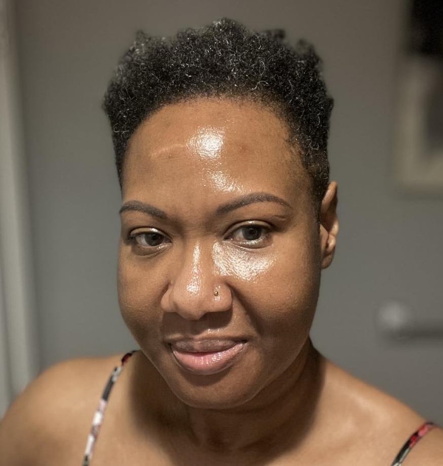 Customer showing her smooth, dewy skin after a few weeks of using the toner