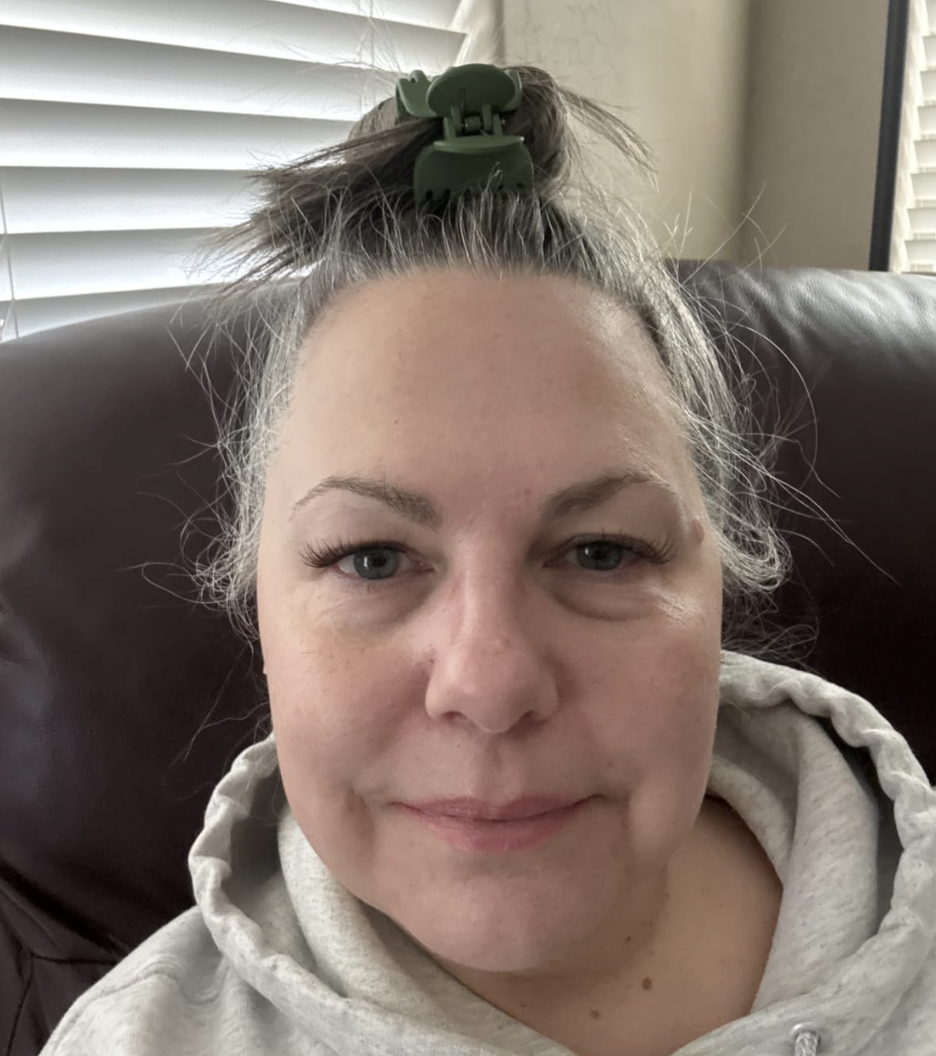 Sandra T. showing her smoother forehead after 60+ days of using the toner