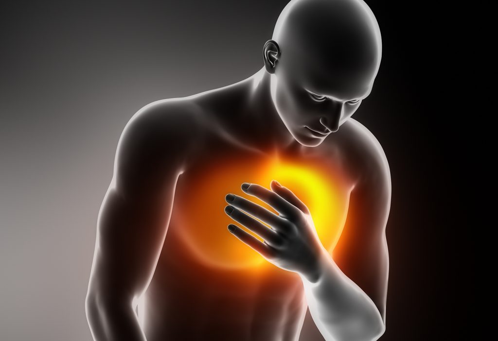 Medical illustration of an artery narrowed by yellow fatty plaque, with red blood cells squeezing through