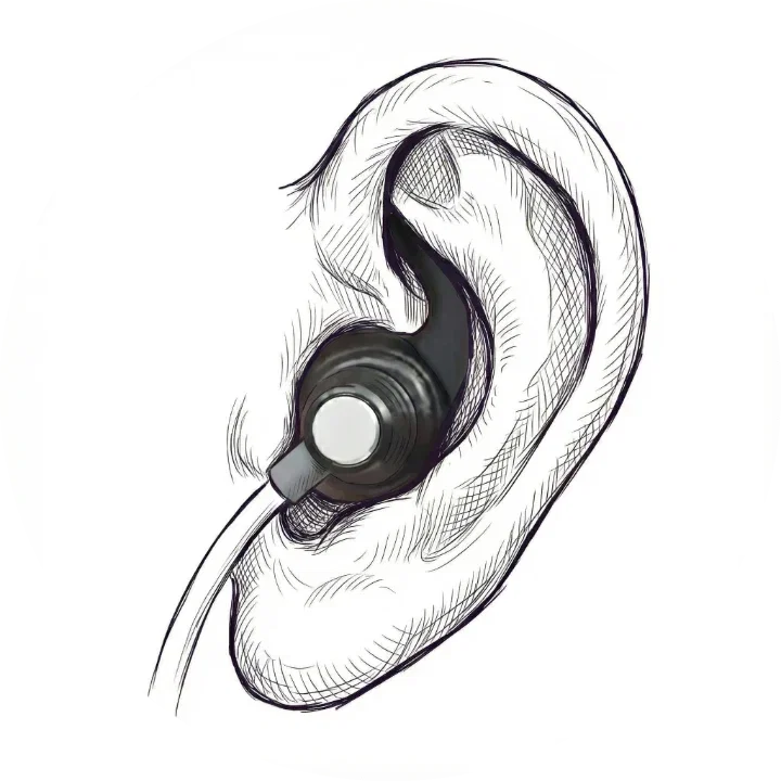 Illustration of ta-VNS ear electrode placement