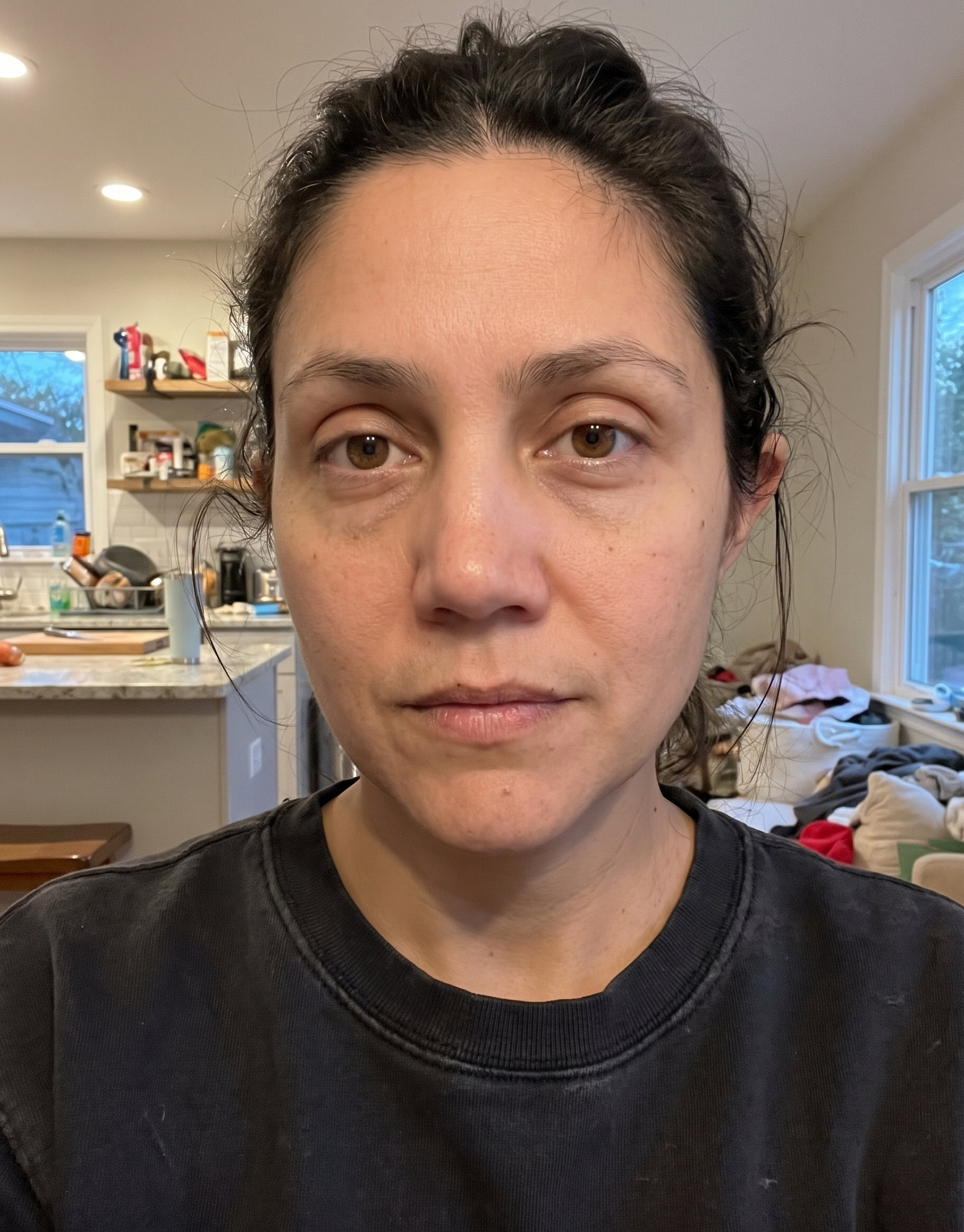 Before: her face one week ago, looking tired with puffiness under the eyes and along the jaw
